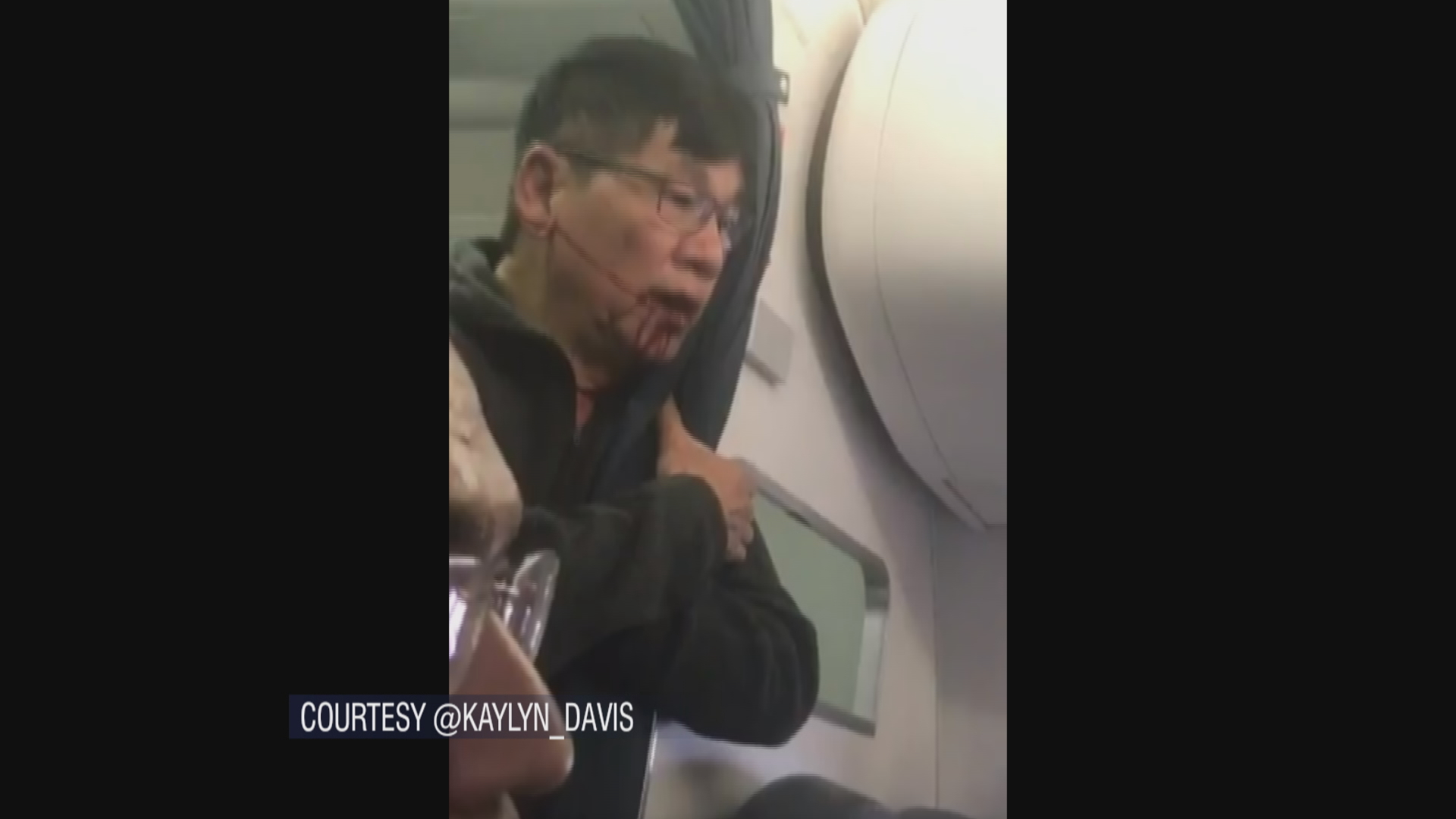 A photo captured on board United Flight 3411 shows Dr. David Dao with blood streaming down his face. (Courtesy of @Kaylyn_Davis)