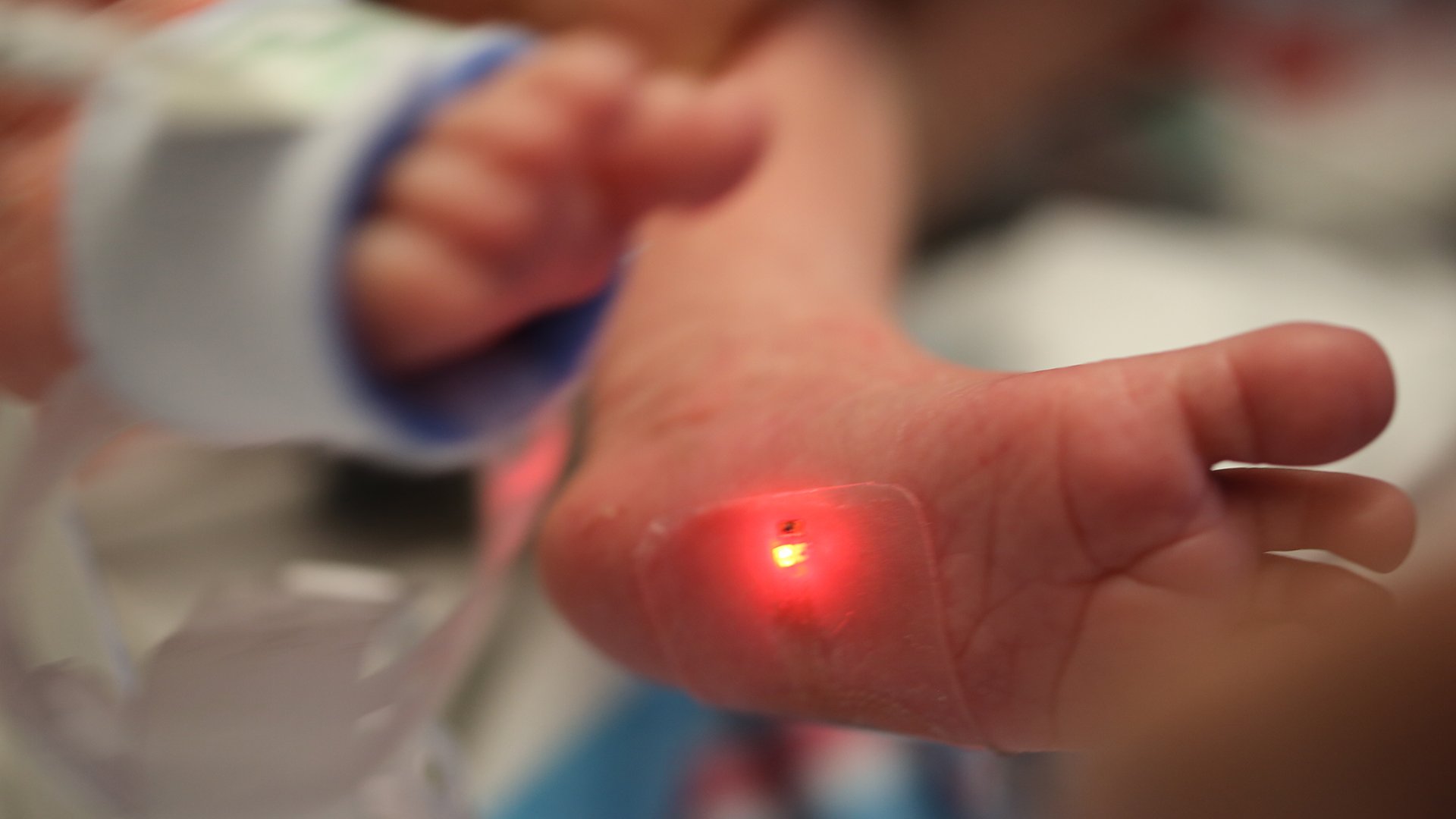 A foot sensor, measuring 2.5 centimeters by 2 centimeters, as seen on an infant in the neonatal intensive care unit. (Courtesy of Northwestern University)
