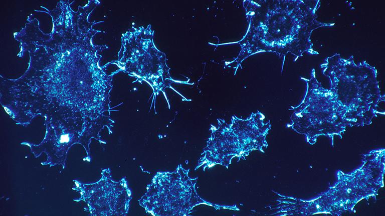 Cancer cells in culture from human connective tissue, illuminated by dark-field amplified contrast, at a magnification of 500 times. (National Cancer Institute)