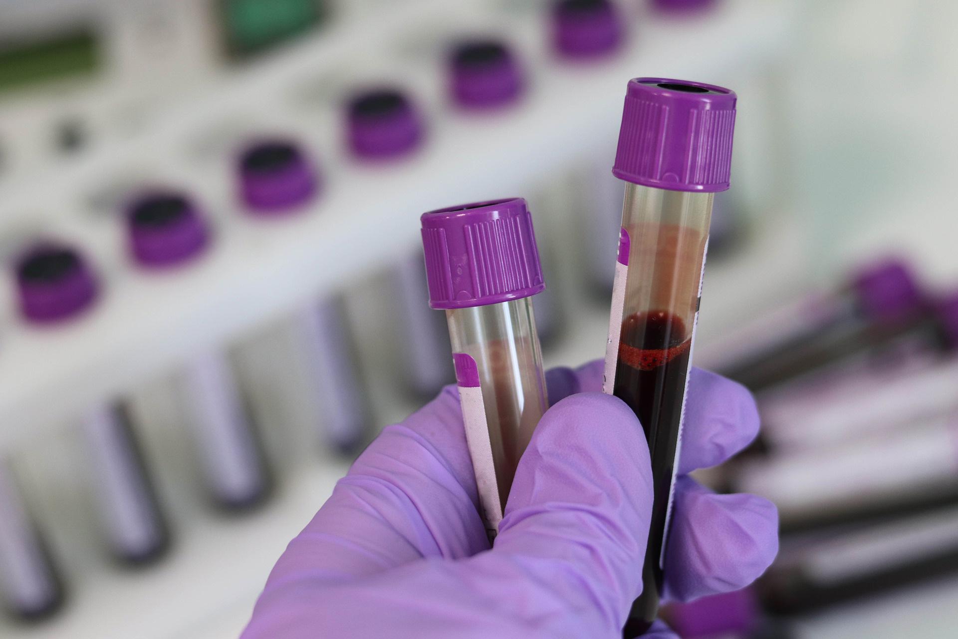 Can a blood test detect cancer?