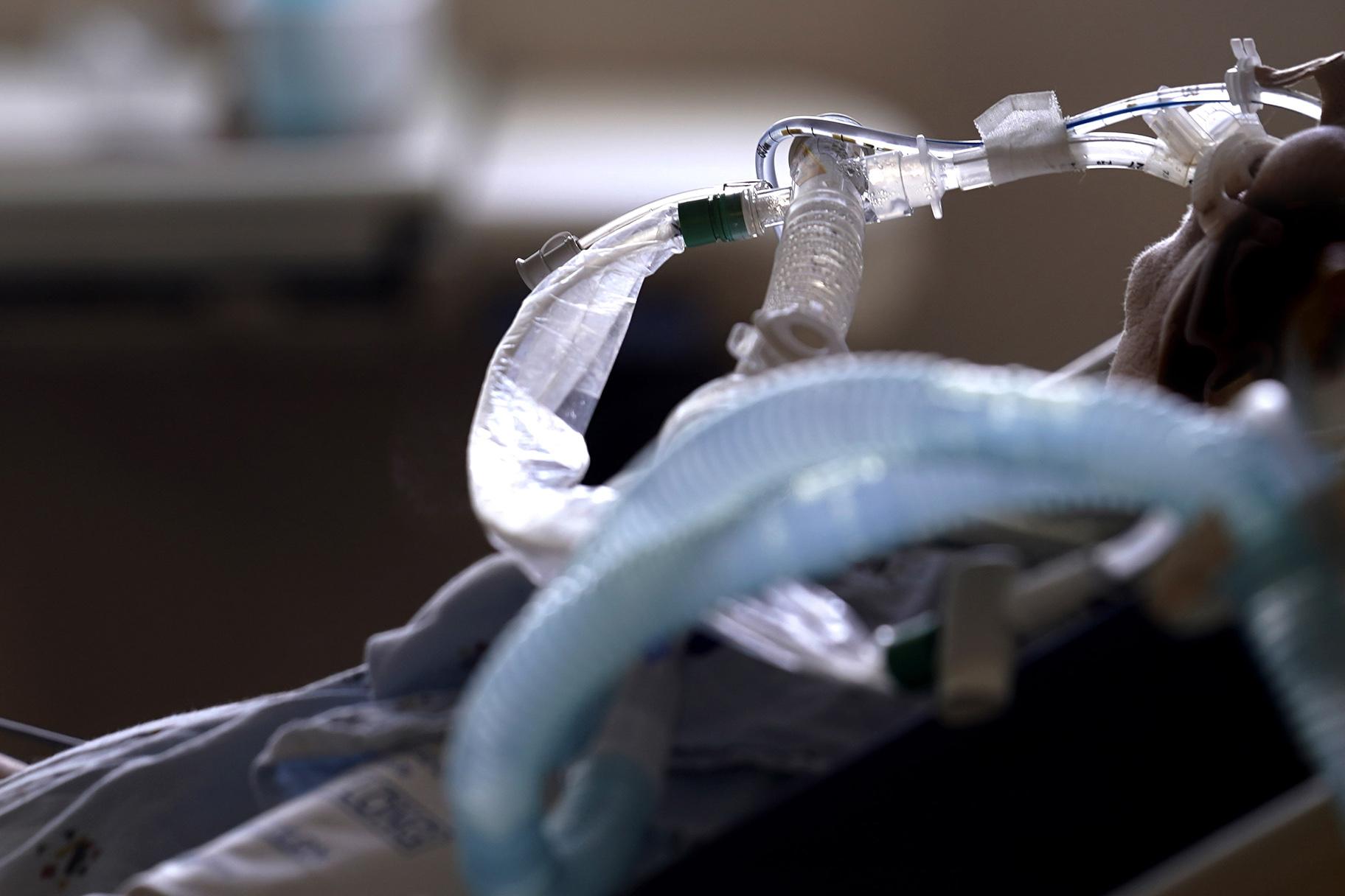 A patient with COVID-19 on breathing support lies in a bed in an intensive care unit at the Willis-Knighton Medical Center in Shreveport, La., Tuesday, Aug. 17, 2021. (AP Photo / Gerald Herbert)