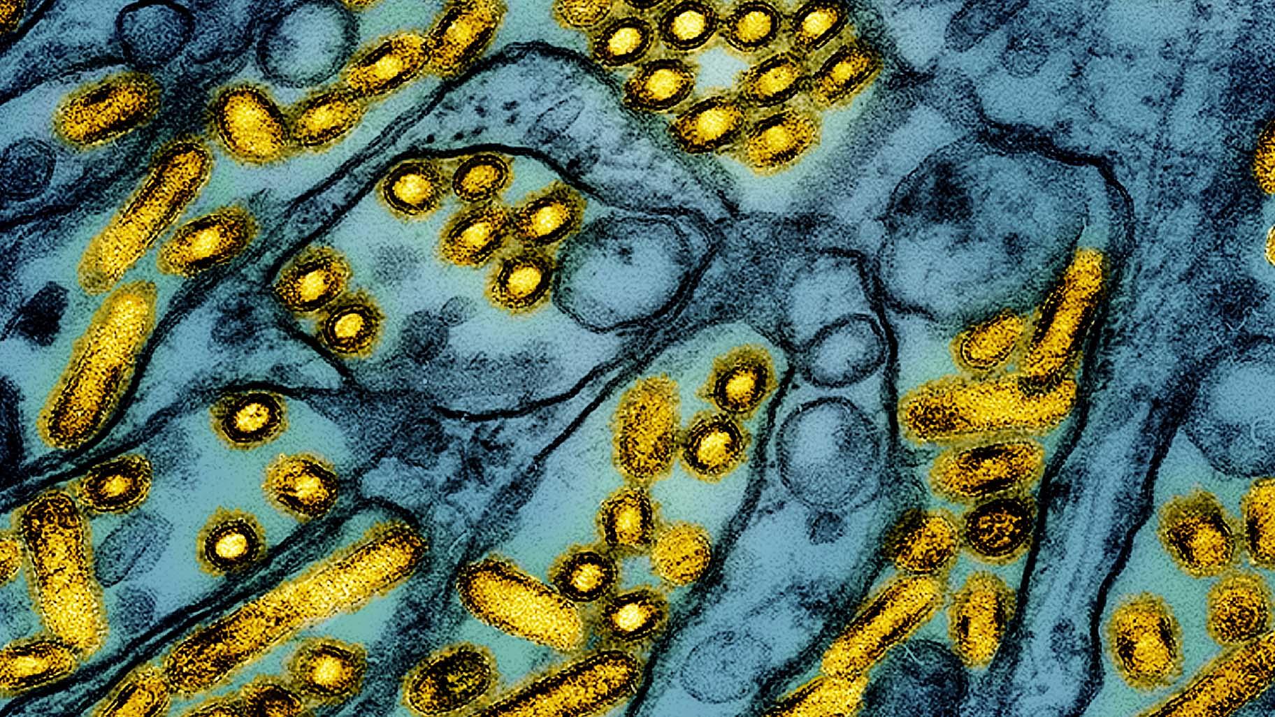 FILE -This colorized electron microscope image released by the National Institute of Allergy and Infectious Diseases on March 26, 2024, shows avian influenza A H5N1 virus particles (yellow), grown in Madin-Darby Canine Kidney (MDCK) epithelial cells (blue). (CDC / NIAID via AP, File) FILE -This colorized electron microscope image released by the National Institute of Allergy and Infectious Diseases on March 26, 2024, shows avian influenza A H5N1 virus particles (yellow), grown in Madin-Darby Canine Kidney (MDCK) epithelial cells (blue). (CDC / NIAID via AP, File)