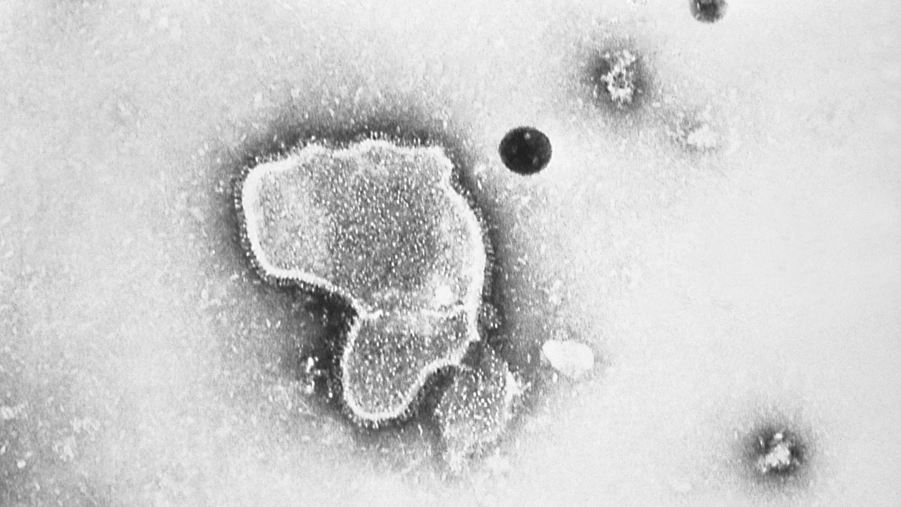 This 1981 photo provided by the Centers for Disease Control and Prevention shows an electron micrograph of Respiratory Syncytial Virus, also known as RSV. (CDC via AP, File)