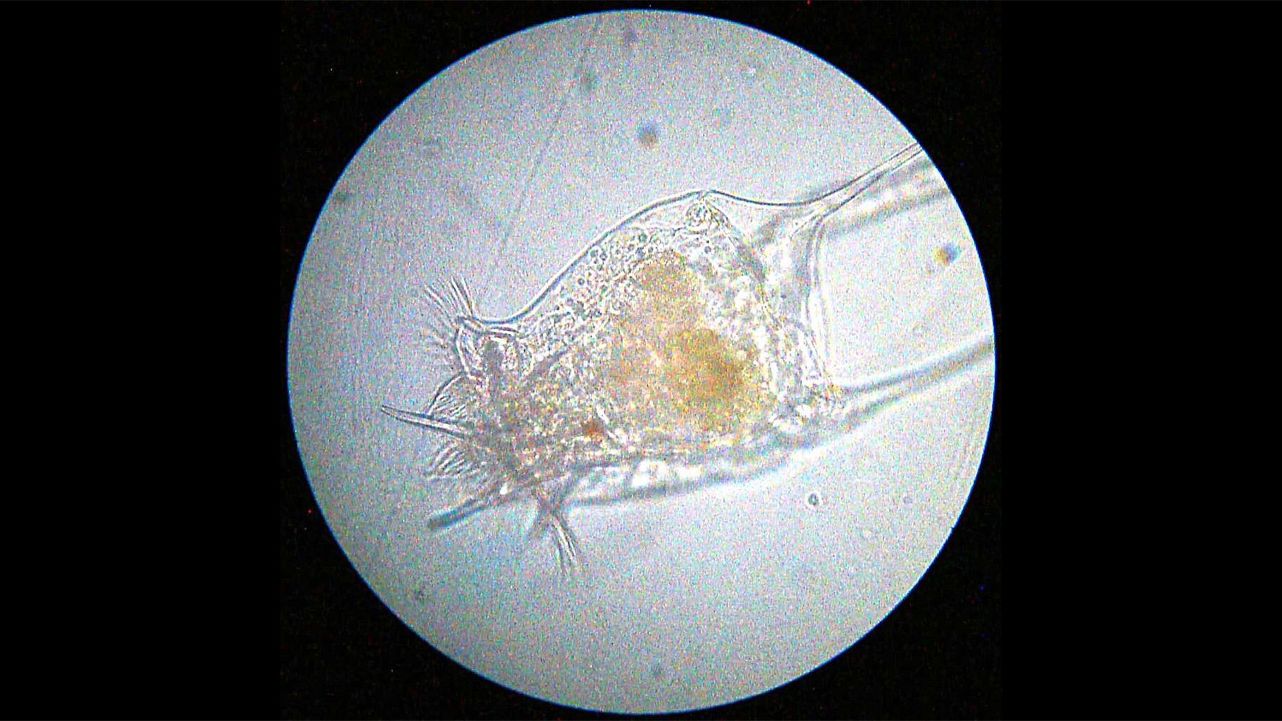 A magnified image of a rotifer (Bob Blaylock / Wikimedia Commons)