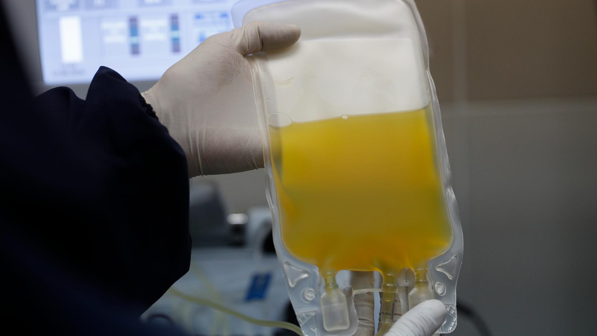  In this Friday, June 12, 2020 file photo, a doctor holds a bag of blood plasma donated by a COVID-19 survivor at a blood bank in La Paz, Bolivia. (AP Photo / Juan Karita)