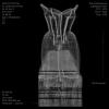 Charles James "Tree," CT scan