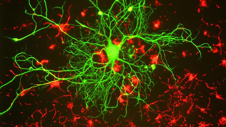 Neuron in tissue culture. (GerryShaw via Wikimedia Commons)