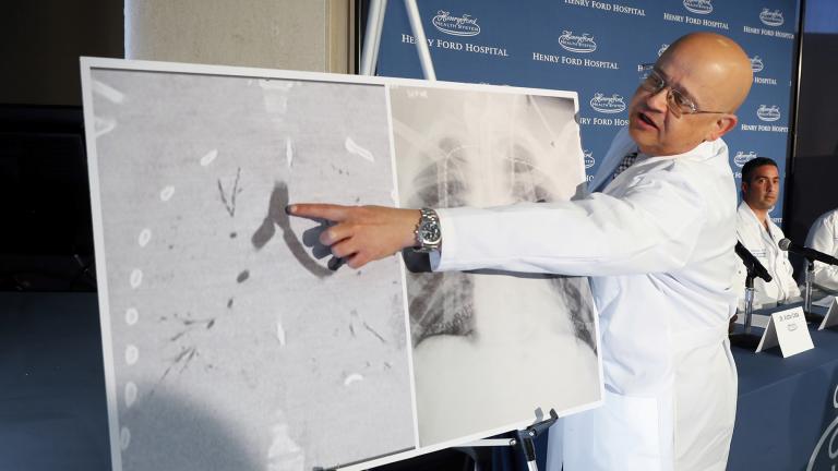 In this Tuesday, Nov. 12, 2019 file photo, Dr. Hassan Nemeh, surgical director of Thoracic Organ Transplant, shows areas of a patient’s lungs during a news conference at Henry Ford Hospital in Detroit. (AP Photo / Paul Sancya)