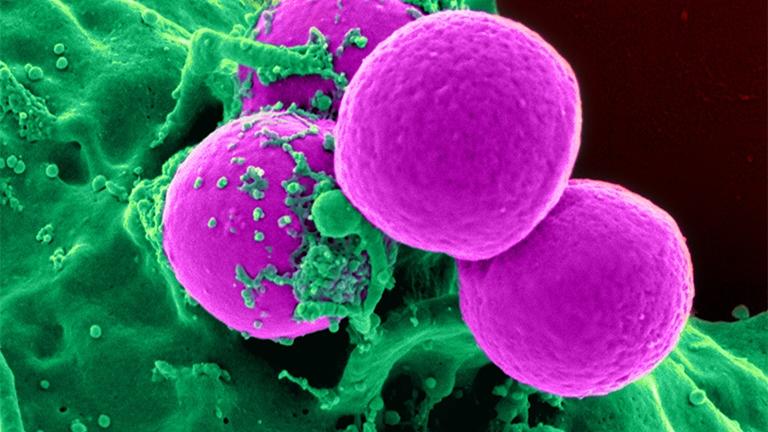 Scanning electron micrograph of a human neutrophil ingesting MRSA (Courtesy of National Institute of Allergy and Infectious Diseases)