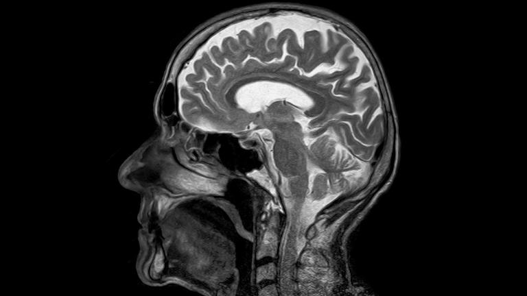 “Research studies have shown that the placebo effect has its own biological properties and has a neurological signature,” said  Marwan Baliki, assistant professor of physical medicine and rehabilitation at Northwestern University Feinberg School of Medicine.