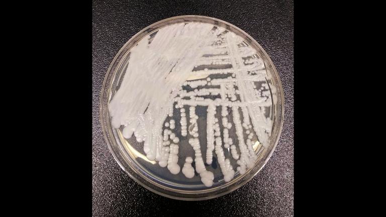 The Candida auris fungus is potentially deadly and can cause a number of infections, some of which are drug-resistant. (Centers for Disease Control and Prevention)