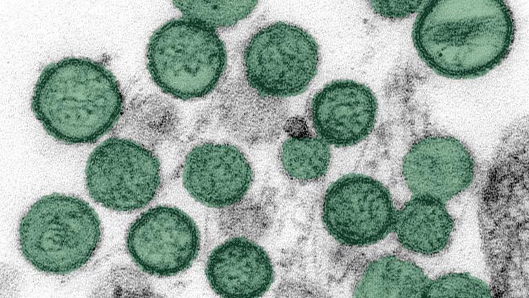 An image of the hantavirus. (CDC)