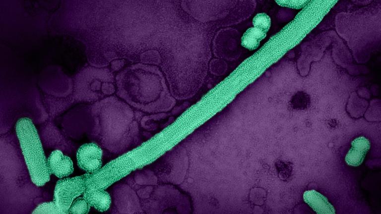 Colorized transmission electron micrograph of influenza A/H3N2 virus particles, isolated from a patient sample and then propagated in cell culture. (Courtesy of NIAID)
