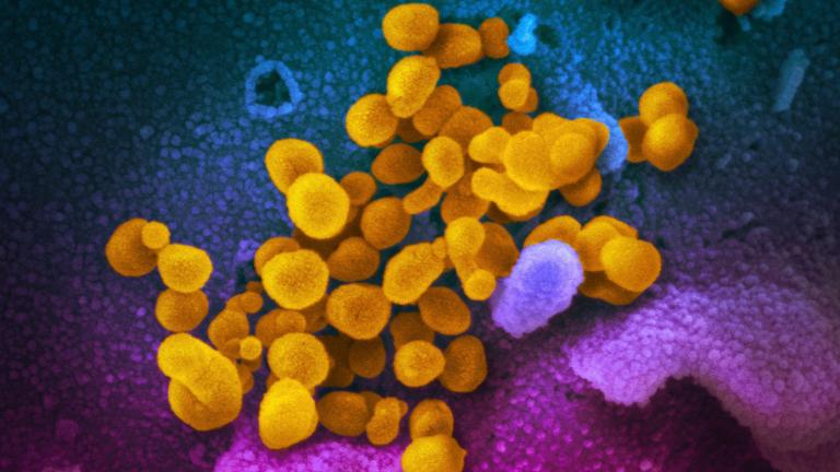 This undated, colorized electron microscope image made available by the U.S. National Institutes of Health in February 2020 shows the Novel Coronavirus SARS-CoV-2, indicated in yellow, emerging from the surface of cells, indicated in blue/pink, cultured in a laboratory. (NIAID-RML via AP, File)