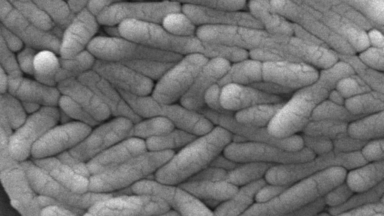 This 2009 electron microscope image provided by the Centers for Disease Control and Prevention shows a large group of Gram-negative Salmonella typhimurium bacteria that had been isolated from a pure culture. (Janice Haney Carr / CDC via AP, File)
