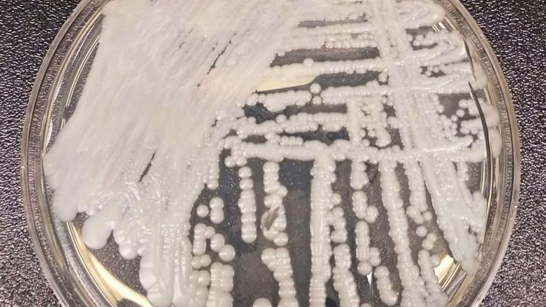 This undated photo made available by the Centers for Disease Control and Prevention shows a strain of Candida auris cultured in a petri dish at a CDC laboratory. (Shawn Lockhart / Centers for Disease Control and Prevention via AP, File)