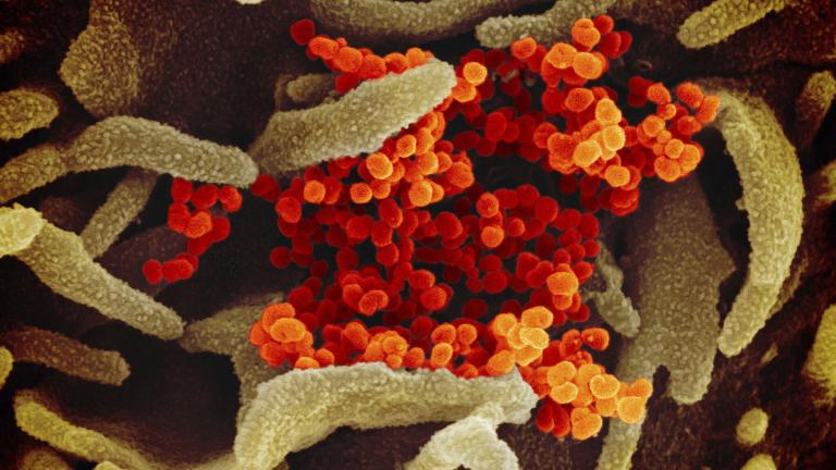 This file image provided by The National Institute of Allergy and Infectious Diseases (NIAID) shows SARS-CoV-2 (orange) the virus that causes COVID-19—isolated from a patient in the U.S., emerging from the surface of cells (green) cultured in the lab. (NIAID-RML via AP)