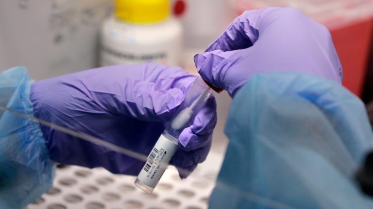 James Robson, a biomedical engineering graduate student, holds a swab and specimen vial in the new COVID-19, on-campus testing lab, Thursday, July 23, 2020, at Boston University in Boston. (AP Photo / Charles Krupa, File)