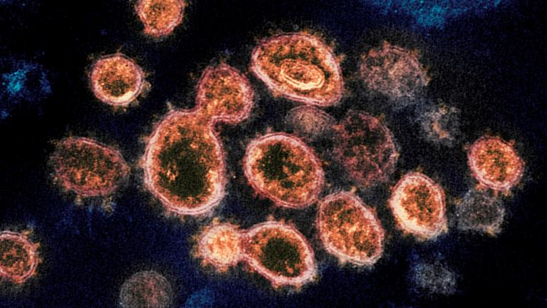 This 2020 electron microscope image provided by the National Institute of Allergy and Infectious Diseases - Rocky Mountain Laboratories shows SARS-CoV-2 virus particles which cause COVID-19, isolated from a patient in the U.S., emerging from the surface of cells cultured in a lab. (NIAID-RML via AP)