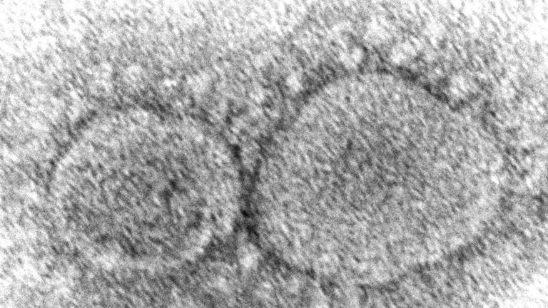 This 2020 electron microscope image made available by the Centers for Disease Control and Prevention shows SARS-CoV-2 virus particles which cause COVID-19. (Hannah A. Bullock, Azaibi Tamin / CDC via AP)