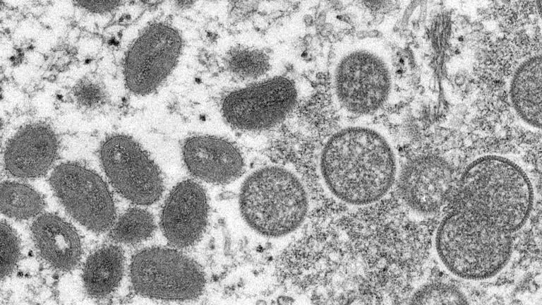 This 2003 electron microscope image made available by the Centers for Disease Control and Prevention shows mature, oval-shaped monkeypox virions, left, and spherical immature virions, right, obtained from a sample of human skin associated with the 2003 prairie dog outbreak. (Cynthia S. Goldsmith, Russell Regner / CDC via AP, File)