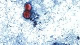 This undated photo taken through a microscope provided by the CDC shows Cyclospora cayetanensis oocysts found in a fresh stool sample which had been prepared with a formalin solution and stained with safranin. (CDC via AP)