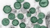 An image of the hantavirus. (CDC)