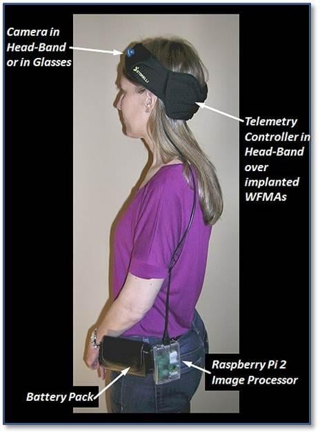 An example of how the intracortical visual prosthesis system might be used on an implanted volunteer. (Courtesy of Philip Troyk and Vernon L. Towle)