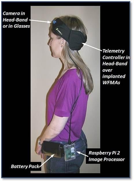 Wireless floating microelectrode array (WFMA) device before