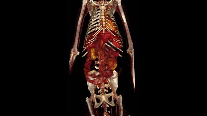 3-D angiography of a spider monkey. (Courtesy of Chicago Zoological Society)