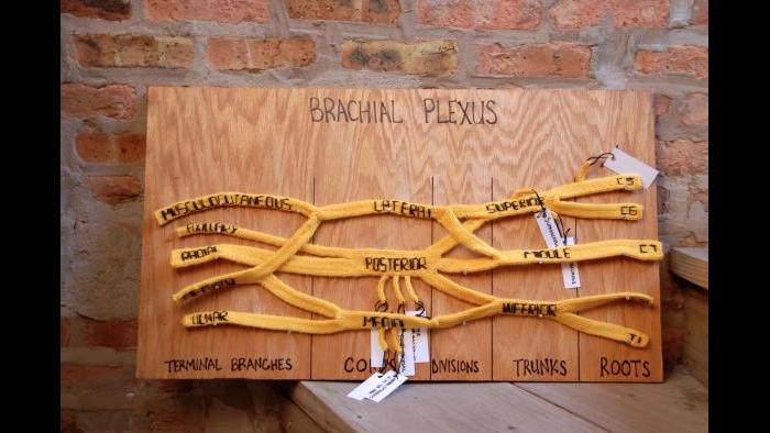 Knitted brachial plexus (Courtesy of Daniel Lam)