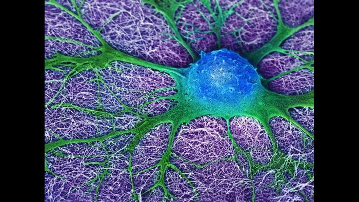 Fifth place: “Neural Cell Looking for Friends” by Mark McClendon.