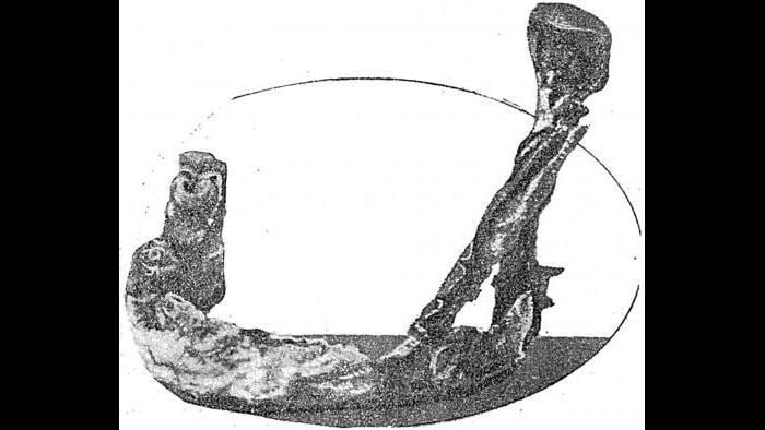 The lower jawbone of Mollie Maggia, the first death among the New Jersey “Radium Girls.” (American Weekly)