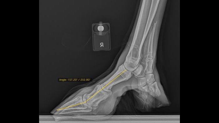 Radiograph of reindeer hooves. (Courtesy of Chicago Zoological Society)